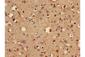 Immunohistochemistry of paraffin-embedded human brain tissue using ABIN7175463 at dilution of 1:100