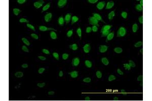 Immunofluorescence of monoclonal antibody to ROD1 on HeLa cell. (PTBP3 antibody  (AA 16-114))