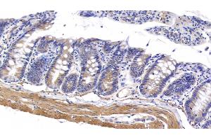Detection of MYH11 in Rat Colon Tissue using Polyclonal Antibody to Myosin Heavy Chain 11, Smooth Muscle (MYH11) (MYH11 antibody  (AA 1-351))