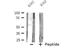 Western blot analysis of extracts from K562 cells, using INA antibody. (INA antibody  (Internal Region))