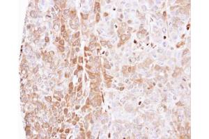 IHC-P Image Immunohistochemical analysis of paraffin-embedded FaDu xenograft, using LXN, antibody at 1:500 dilution. (Latexin antibody)