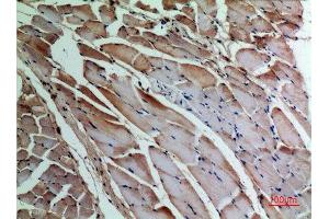Immunohistochemistry (IHC) analysis of paraffin-embedded Rat Muscle, antibody was diluted at 1:100. (alpha-SMA (C-Term) antibody)