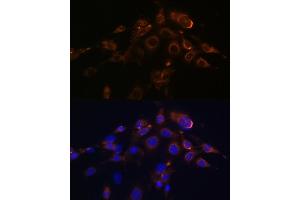 Immunofluorescence analysis of NIH-3T3 cells using DR5/TR/TNFRSF10B Rabbit mAb (ABIN7271062) at dilution of 1:100 (40x lens). (TNFRSF10B antibody)