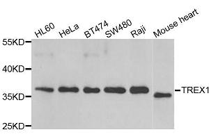 Western blot analysis of extracts of various cell lines, using TREX1 antibody. (TREX1 antibody  (AA 1-270))