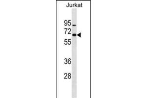 ZN Antibody (N-term) (ABIN1882022 and ABIN2838605) western blot analysis in Jurkat cell line lysates (35 μg/lane). (ZNF358 antibody  (N-Term))
