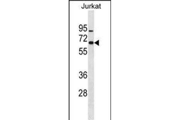 ZNF358 Antikörper  (N-Term)