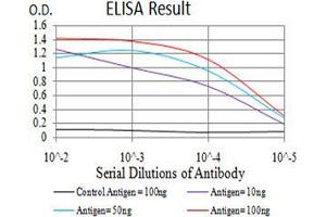 Black line: Control Antigen (100 ng),Purple line: Antigen (10 ng), Blue line: Antigen (50 ng), Red line:Antigen (100 ng) (beta 2 Adrenergic Receptor antibody  (AA 302-413))