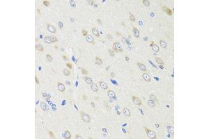Immunohistochemistry of paraffin-embedded rat brain using CRABP2 antibody (ABIN1882301) at dilution of 1:100 (40x lens). (CRABP2 antibody)