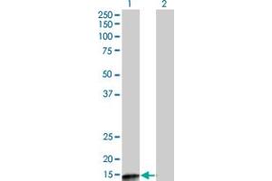 Western Blot analysis of PPP3R2 expression in transfected 293T cell line by PPP3R2 monoclonal antibody (M07), clone 5D9.