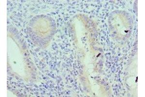 Immunohistochemistry of paraffin-embedded human epityphlon tissue using ABIN7156833 at dilution of 1:100 (IL18RAP antibody  (AA 390-599))