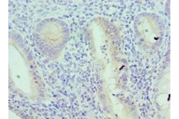 IL18RAP antibody  (AA 390-599)