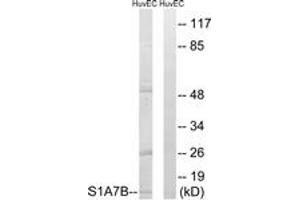 Western blot analysis of extracts from HuvEc cells, using S100A7L2 Antibody. (S100A7L2 antibody  (AA 38-87))