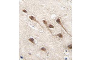 Immunohistochemistry (Paraffin-embedded Sections) (IHC (p)) image for anti-Runt-Related Transcription Factor 1 (RUNX1) (AA 227-255) antibody (ABIN650732)
