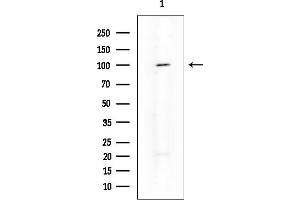 anti-alpha-Actinin Skeletal Muscle (ACTN) (Internal Region) antibody