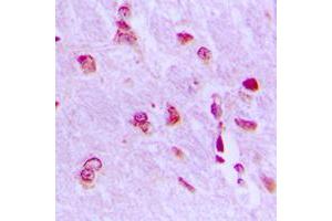 Immunohistochemical analysis of ARHGAP18 staining in human brain formalin fixed paraffin embedded tissue section. (ARHGAP18 antibody  (C-Term))