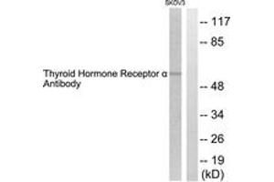 Western blot analysis of extracts from SKOV3 cells, using Thyroid Hormone Receptor alpha Antibody. (THRA antibody  (AA 10-59))