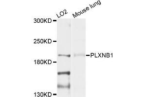 Western blot analysis of extracts of various cell lines, using PLXNB1 antibody (ABIN4904796) at 1:1000 dilution. (PLXNB1 antibody)