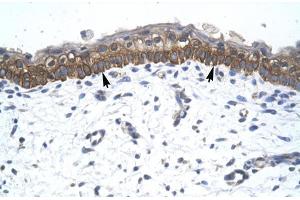 Human Skin; ZNF385 antibody - C-terminal region in Human Skin cells using Immunohistochemistry (ZNF385A antibody  (C-Term))