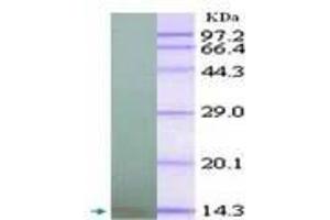 Image no. 2 for anti-Chemokine (C-X-C Motif) Ligand 10 (CXCL10) antibody (ABIN791563) (CXCL10 antibody)