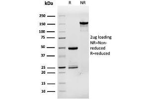 SDS-PAGE Analysis Purified TFF1/ps2 Mouse Monoclonal Antibody (rTFF1/1091). (Recombinant TFF1 antibody)