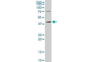 TMOD3 polyclonal antibody (A01), Lot # 060703JCS1 Western Blot analysis of TMOD3 expression in HeLa . (TMOD3 antibody  (AA 280-352))