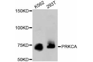 Western blot analysis of extracts of various cell lines, using PRKCA antibody (ABIN5997085).