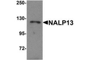 Western blot analysis of NALP13 in K562 cell lysate with NALP13 antibody at 1 μg/ml. (NLRP13 antibody  (N-Term))