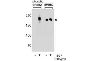 Western blot analysis of extracts from A431 cells, untreated or treated with EGF (100ng/ml) using p-ERBB2 antibody (left) or nonphos Ab (right) (ErbB2/Her2 antibody  (pTyr1196))