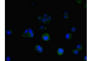 Immunofluorescent analysis of MCF-7 cells using ABIN7172947 at dilution of 1:100 and Alexa Fluor 488-congugated AffiniPure Goat Anti-Rabbit IgG(H+L) (TM9SF1 antibody  (AA 28-230))