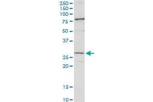 CFDP1 polyclonal antibody (A01). (CFDP1 antibody  (AA 168-251))