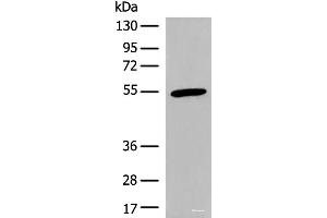 Western blot analysis of Human heart tissue lysate using CIR1 Polyclonal Antibody at dilution of 1:600 (CIR1 antibody)