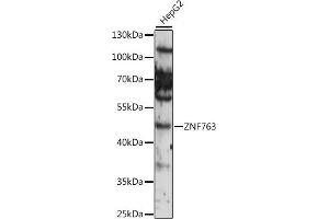 Western blot analysis of extracts of various cell lines, using ZNF763 antibody (ABIN7271529) at 1:1000 dilution. (ZNF763 antibody  (AA 315-370))