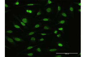 Immunofluorescence of purified MaxPab antibody to NFATC2IP on HeLa cell. (NFATC2IP antibody  (AA 1-138))