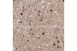 Immunohistochemical staining of human cerebral cortex with SIPA1L1 polyclonal antibody  shows strong nuclear positivity in neuronal cells. (SIPA1L1 antibody)