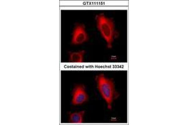 EEF1D antibody  (AA 310-647)