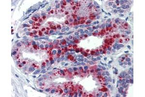 KCNK9 antibody was used for immunohistochemistry at a concentration of 4-8 ug/ml. (KCNK9 antibody  (N-Term))