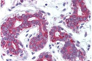 Human Breast (formalin-fixed, paraffin-embedded) stained with TNFSF11 antibody ABIN214007 at 5 ug/ml followed by biotinylated goat anti-rabbit IgG secondary antibody ABIN481713, alkaline phosphatase-streptavidin and chromogen. (RANKL antibody  (Internal Region))