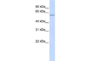 WB Suggested Anti-LRRC15 Antibody Titration:  0. (LRRC15 antibody  (N-Term))