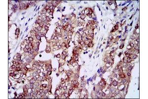 Immunohistochemistry (IHC) image for anti-Heat Shock Protein 90kDa alpha (Cytosolic), Class A Member 1 (HSP90AA1) antibody (ABIN969528)
