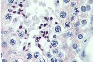 Human Testis: Formalin-Fixed, Paraffin-Embedded (FFPE) (PRDM9 antibody  (AA 431-480))