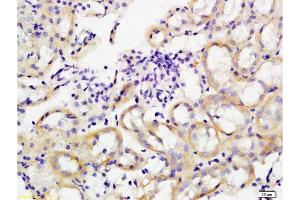 Formalin-fixed and paraffin embedded rat kidney tissue labeled with Anti-GPIIb Polyclonal Antibody, Unconjugated at 1:200 followed by conjugation to the secondary antibody, (SP-0023), and DAB staining (Integrin Alpha2b antibody  (AA 351-450))