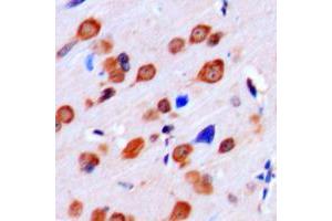Immunohistochemical analysis of LMTK2 staining in human brain formalin fixed paraffin embedded tissue section. (LMTK2 antibody  (Center))