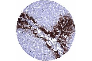 Glutamine Synthetase staining is strong in centrilobular hepatocytes weak to moderate in Kupffer cells but absent in periportal hepatocytes (GLN1 antibody  (AA 50-250))