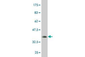 Western Blot detection against Immunogen (36. (UHRF1 antibody  (AA 694-793))