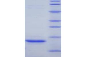 SDS-PAGE (SDS) image for Myoglobin (MB) (AA 1-154) protein (His tag) (ABIN1080354) (Myoglobin Protein (MB) (AA 1-154) (His tag))
