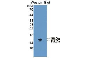 Western blot analysis of the recombinant protein. (Vip antibody  (AA 34-157))