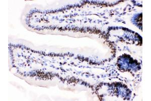 Anti-MCM3 antibody, IHC(P) IHC(P): Mosue Intestine Tissue (MCM3 antibody  (N-Term))