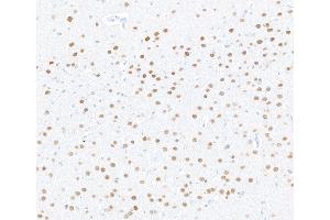 Immunohistochemistry (IHC) image for anti-Myocyte Enhancer Factor 2C (MEF2C) (AA 425-475) antibody (ABIN7795747) (Recombinant MEF2C antibody  (AA 425-475))