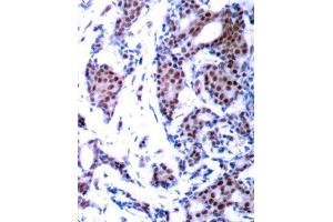 Immunohistochemistry (IHC) image for anti-Jun Proto-Oncogene (JUN) (pSer73) antibody (ABIN3019560) (C-JUN antibody  (pSer73))
