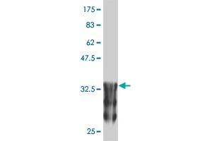 Western Blot detection against Immunogen (37. (ANKRD17 antibody  (AA 2501-2603))